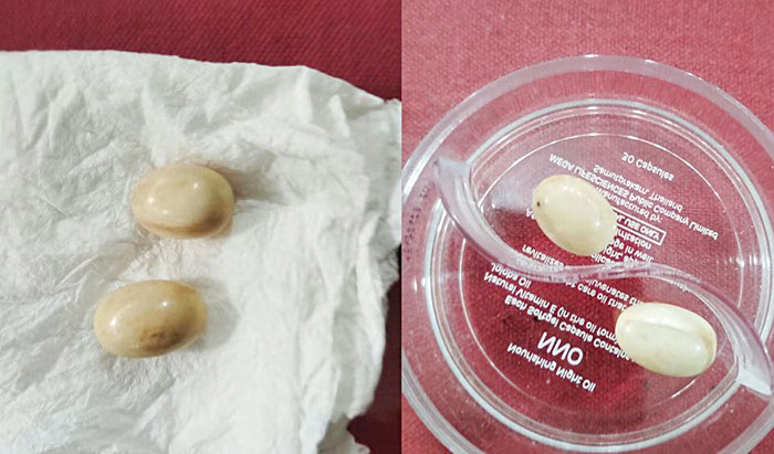Two elephant pearls worth Rs 42.5 mn recovered by Wildlife officers during raid at a Biyagama hotel
